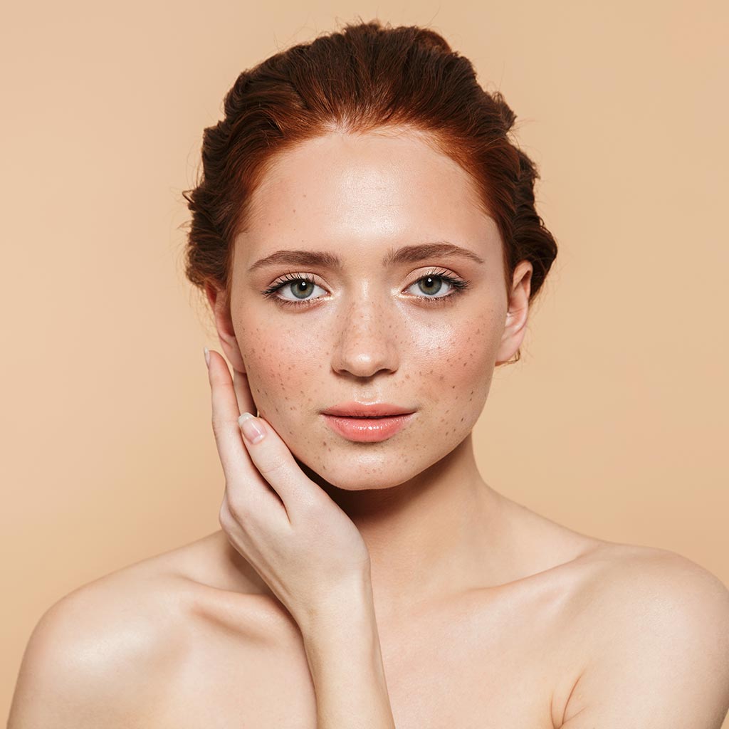Pigmentation