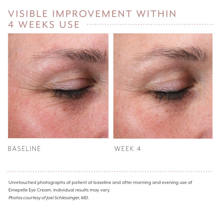 Emepelle Eye Cream