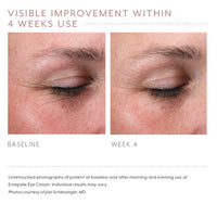 Emepelle Eye Cream