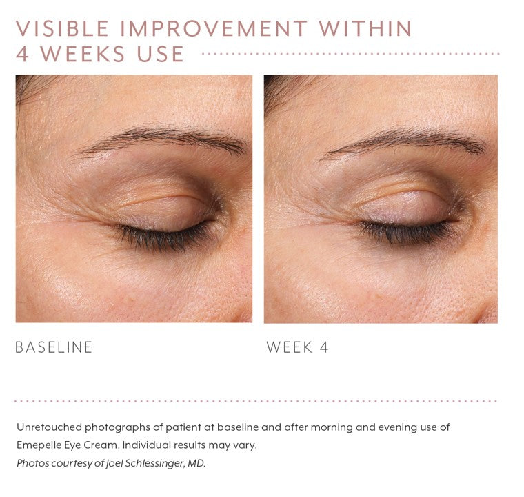 Emepelle Eye Cream