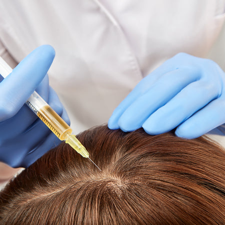 mesotherapy hair